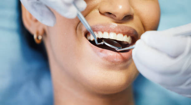 Best Cosmetic Emergency Dentistry in Huber Ridge, OH