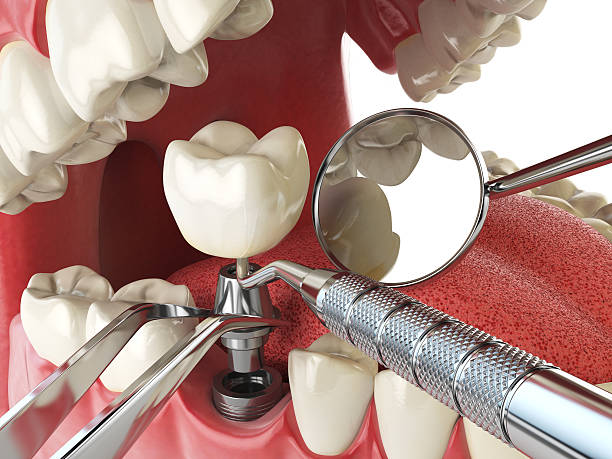 Best Emergency Gum Treatment in Huber Ridge, OH